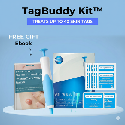 TagBuddy Kit – No More Skin Tags