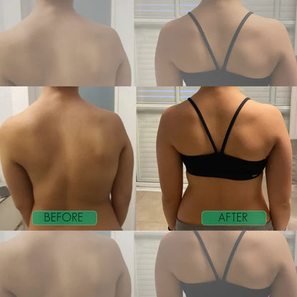 Instant Posture Corrector